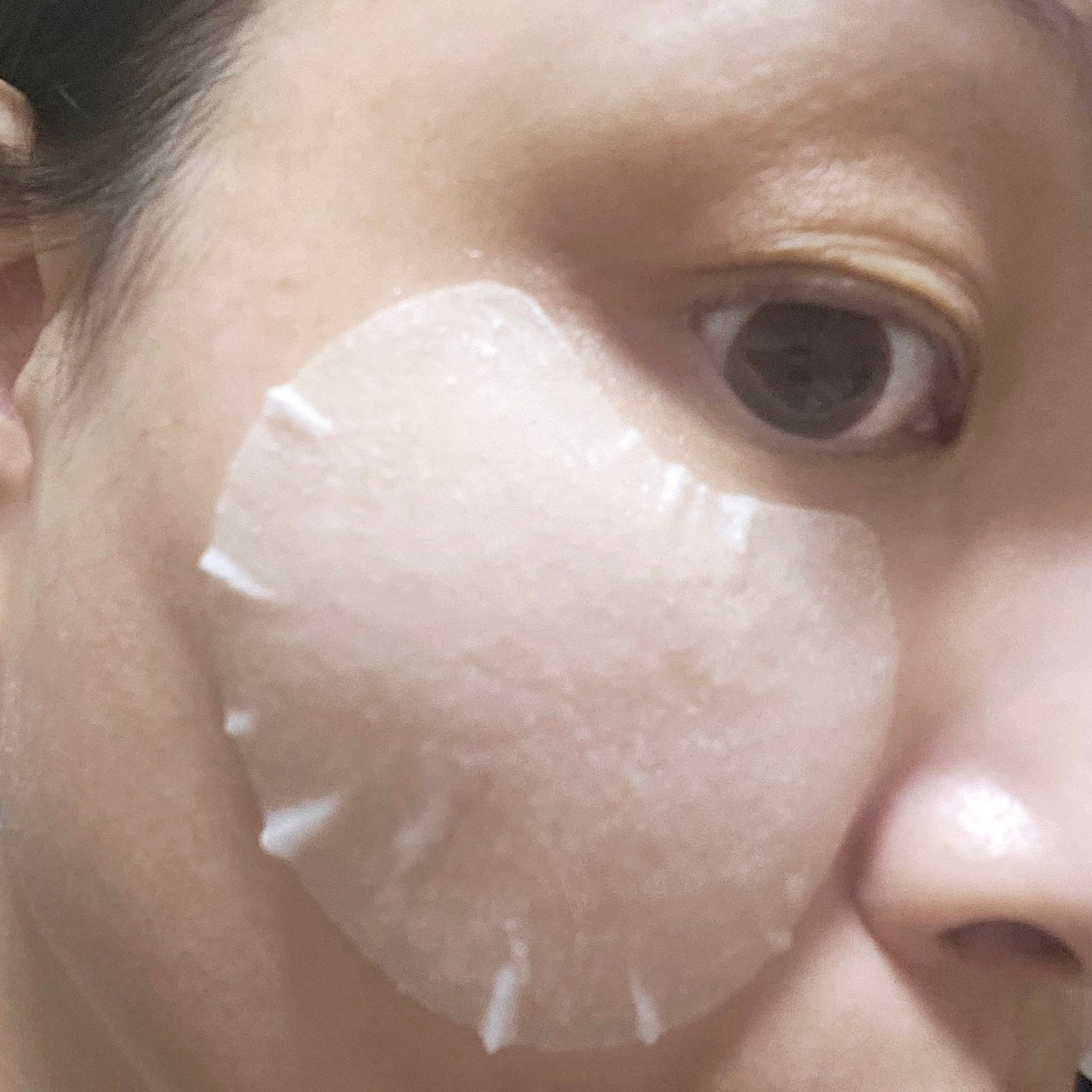 センテラ クイックカーミングパッド/SKIN1004/トナーパッドを使ったクチコミ(7枚目)