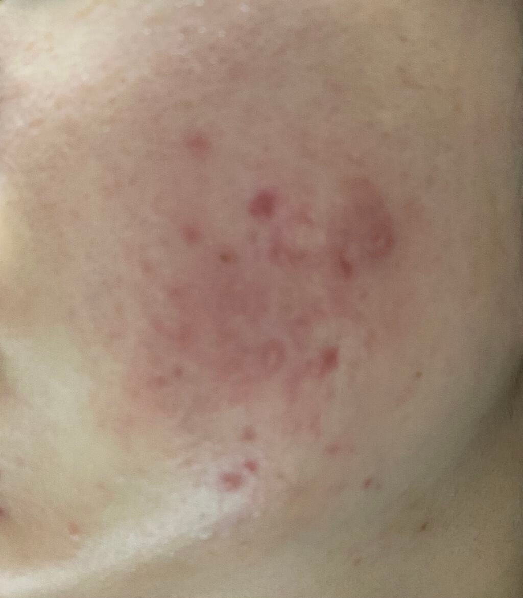 ra on LIPS 「7月5日お風呂あがりにぺピオゲル塗って外カメで撮りました。だい..」(3枚目)