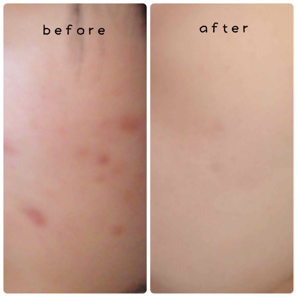 ハトムギ化粧水(ナチュリエ スキンコンディショナー R )/ナチュリエ/化粧水を使ったクチコミ（2枚目）