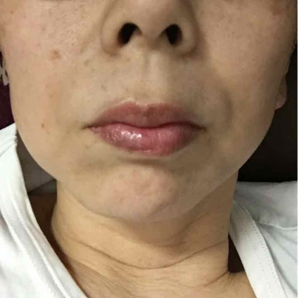 レジェンドエイジ リップ/LEGEND AGE/リップクリームを使ったクチコミ（2枚目）