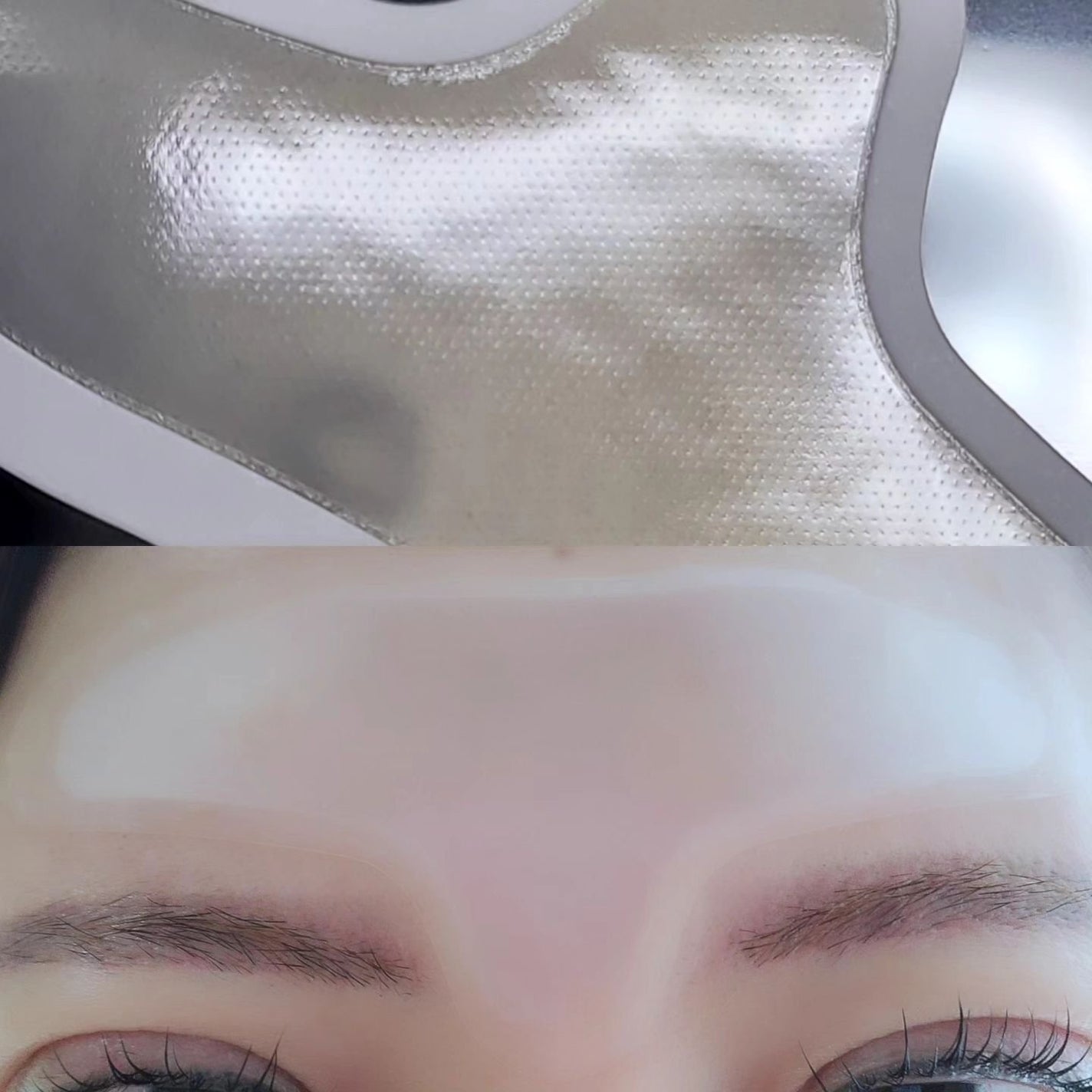 メディリフト マイクロフィラー フォアヘッド/YA-MAN TOKYO JAPAN/頭皮ケアを使ったクチコミ(3枚目)