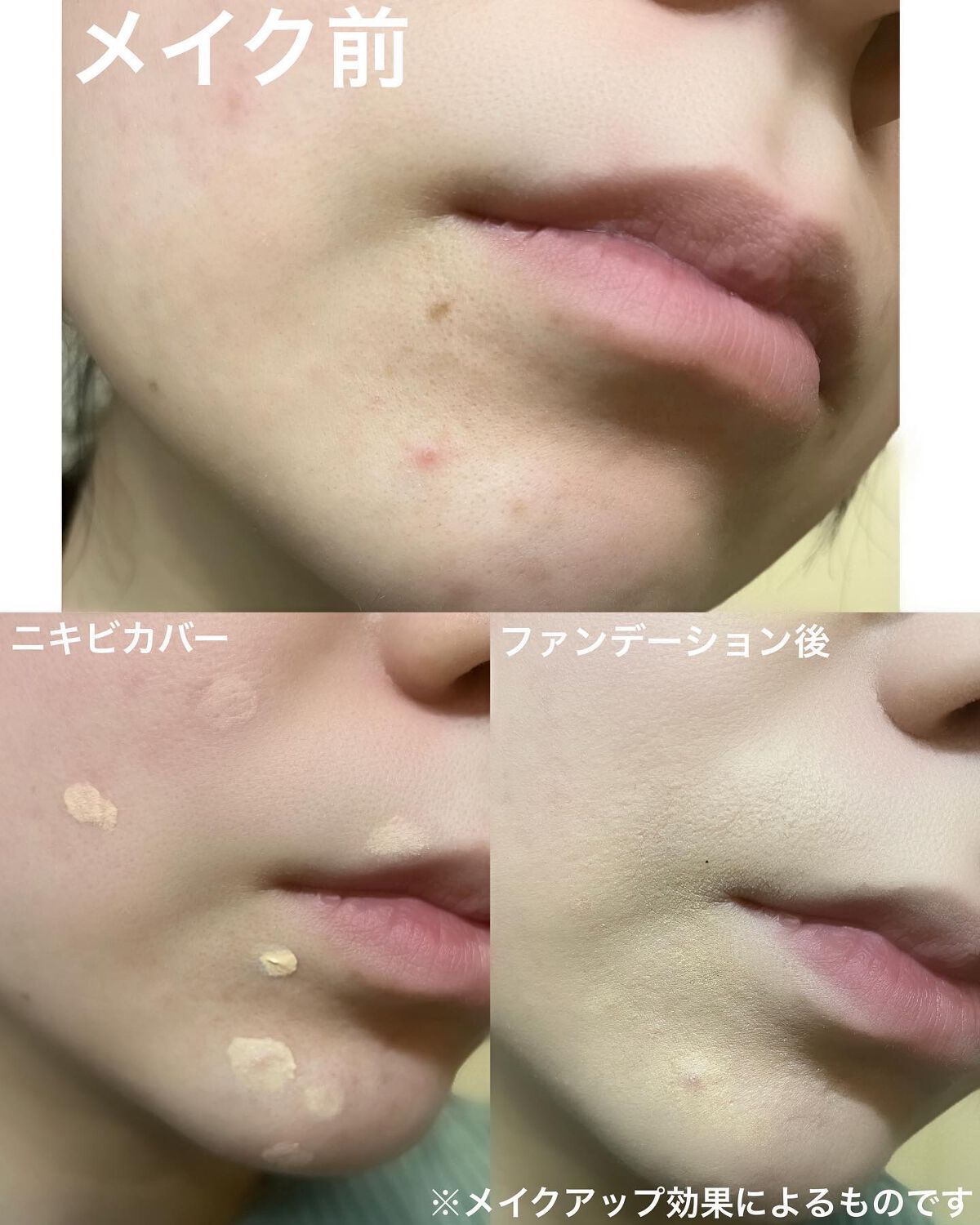 イプノス シーバムクリア リペアクリーム/ACSEINE/フェイスクリームを使ったクチコミ(5枚目)