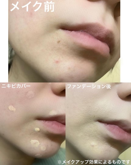 イプノス シーバムクリア リペアクリーム/ACSEINE/フェイスクリームを使ったクチコミ(5枚目)