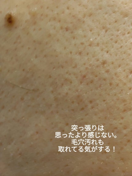 ディープクリア酵素洗顔 /メラノCC/洗顔フォームを使ったクチコミ(6枚目)