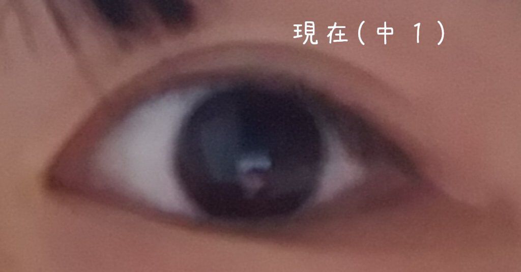 セリア アイテープ片面(のびる)絆創膏タイプ スリム 120枚のクチコミ「こんにちは  👧🏻09 です。

初投稿失礼しますm(*_ _)m
今日はおすすめのアイテープ.....」（3枚目）