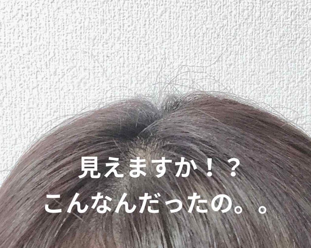 ヘアメンテナンスエマルジョン/プロカリテ/ヘアミルクを使ったクチコミ（2枚目）