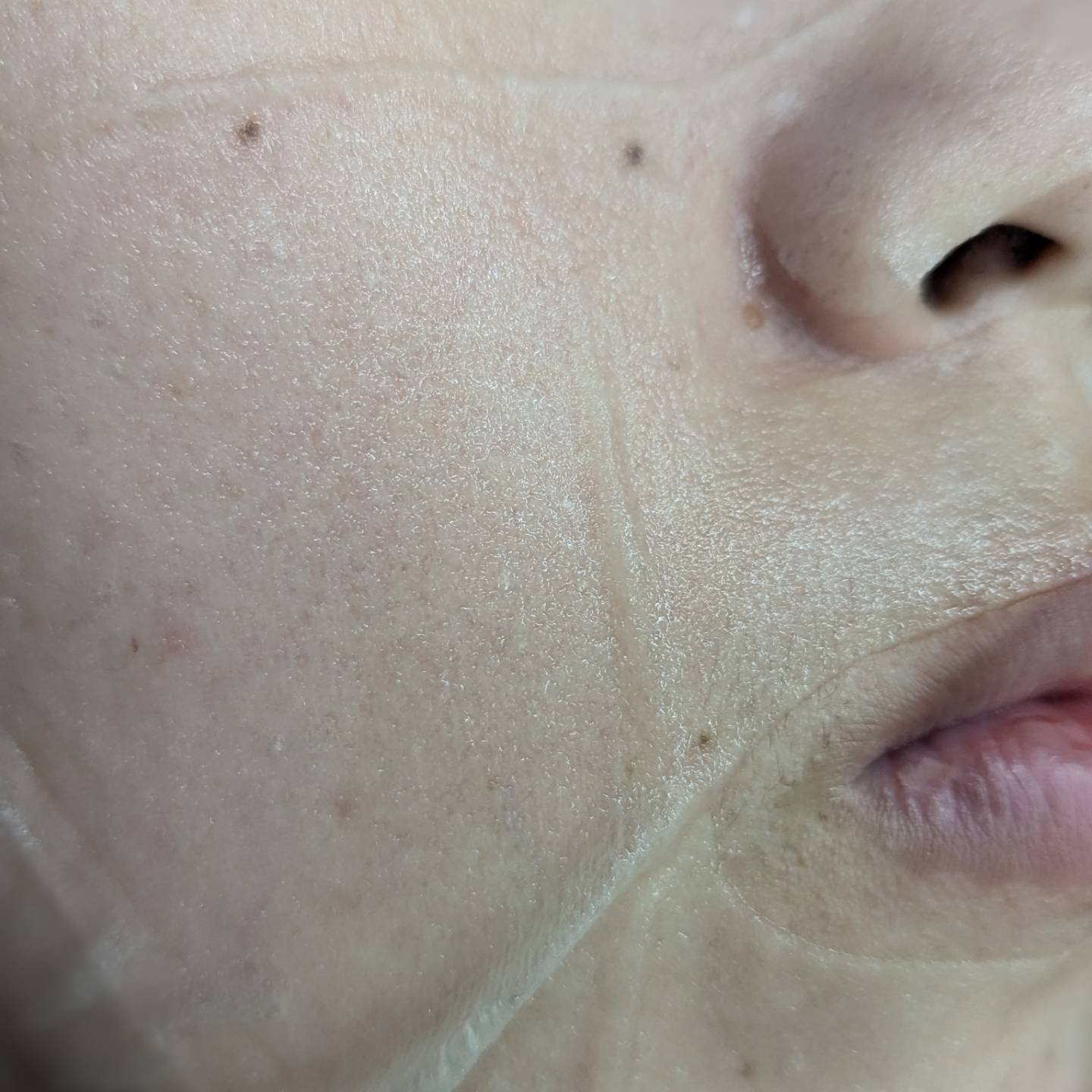 ビタグロウマスク/Dr.Althea/シートマスク・パックを使ったクチコミ（2枚目）