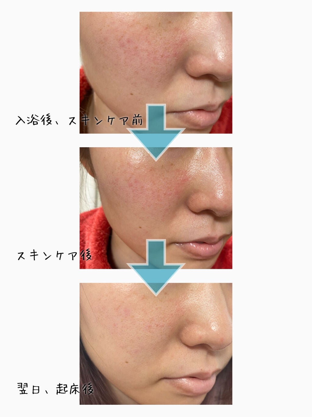 PHセンシティブアンプル/SAM'U/美容液を使ったクチコミ(3枚目)