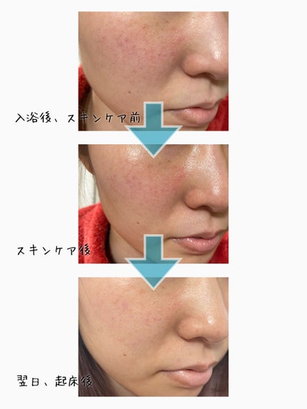 PHセンシティブアンプル/SAM'U/美容液を使ったクチコミ(3枚目)