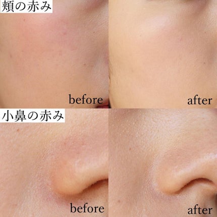 ミネラルコンシーラーパレット/エトヴォス/パレットコンシーラーを使ったクチコミ(5枚目)