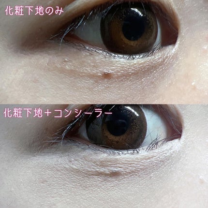 タトゥーウォータープルーフスカーコンシーラー/フォレンコス/リキッドコンシーラーを使ったクチコミ(7枚目)