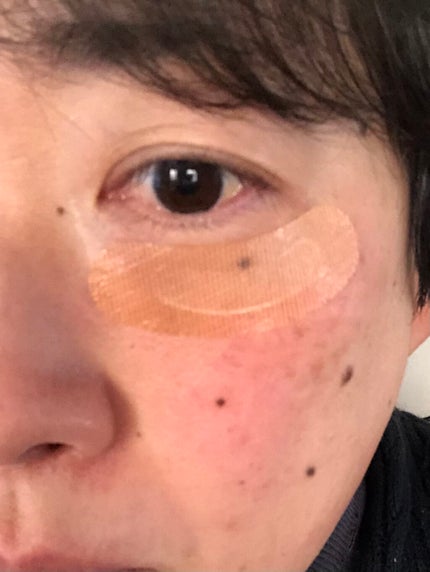 クオニス ダーマフィラープレミア/Quanis/シートマスク・パックを使ったクチコミ(3枚目)