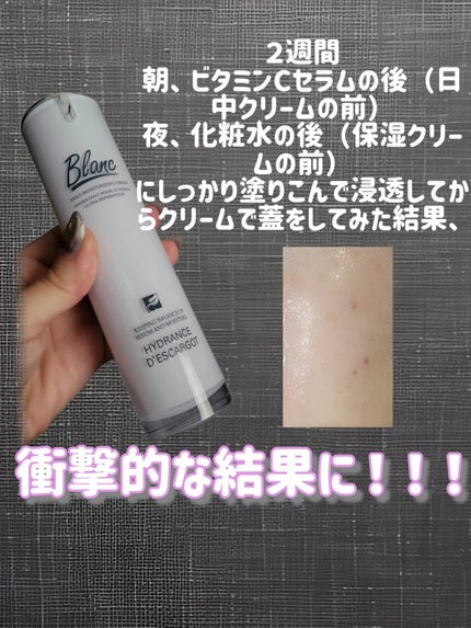 ブラン マジックカタツムリクリームのクチコミ「2週間徹底的にケアしてニキビ跡が薄くなるかの実験をしてみたんだけど、衝撃的な結果に。
実は、.....」(3枚目)