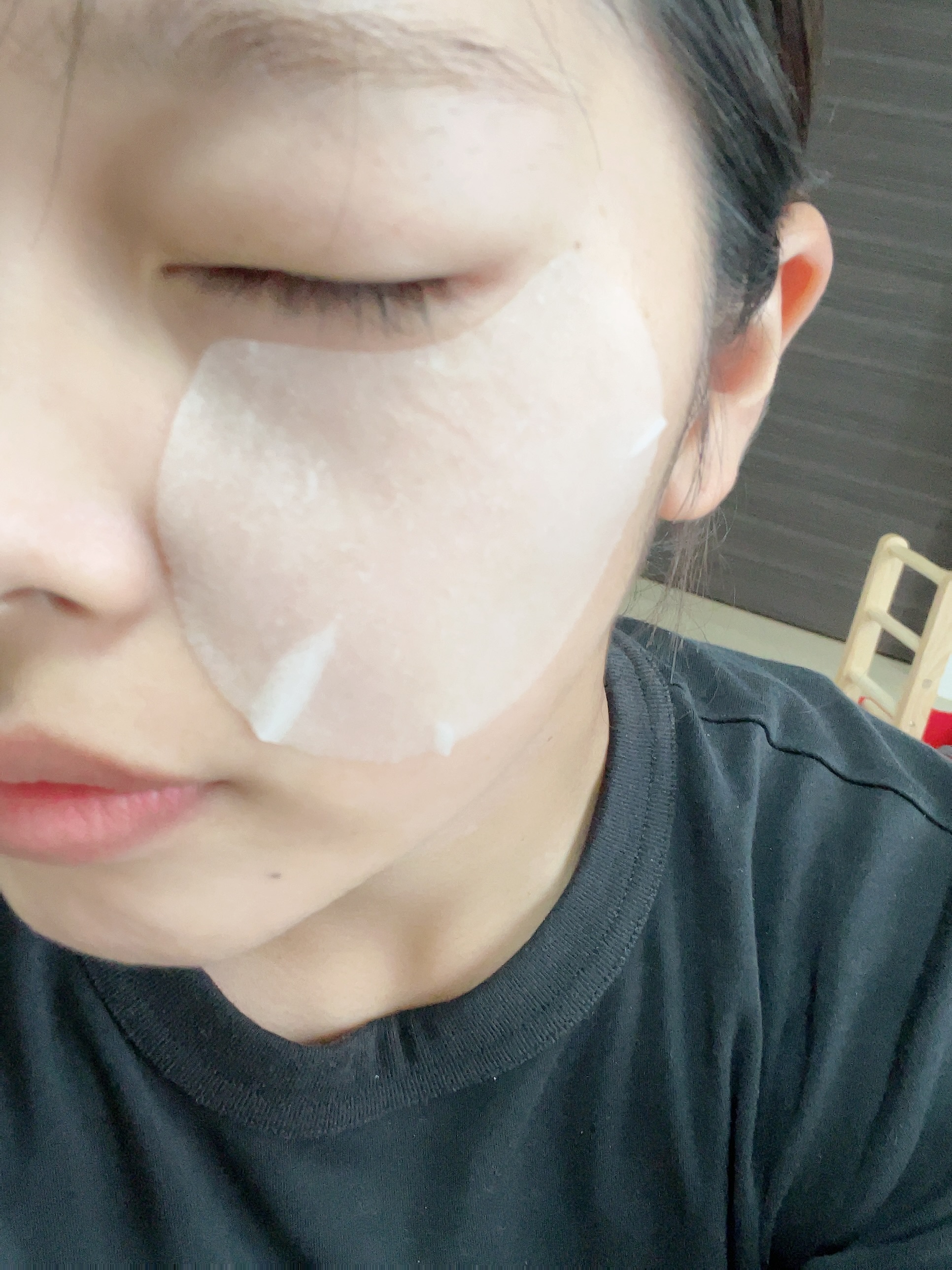 センテラ クイックカーミングパッド/SKIN1004/トナーパッドを使ったクチコミ（1枚目）