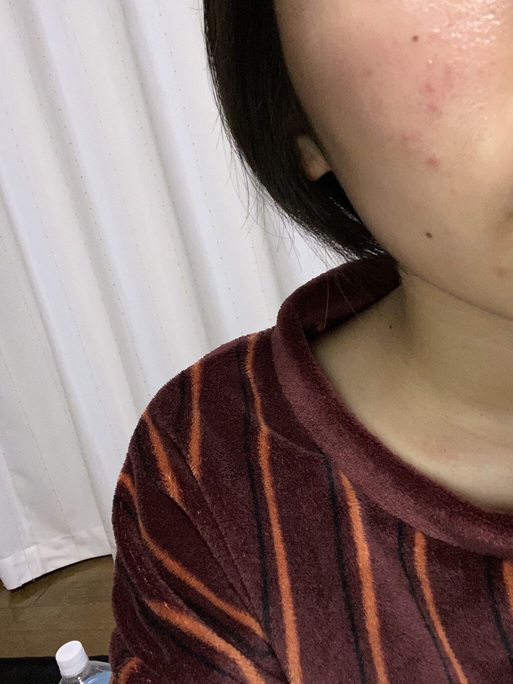 明色美顔水 薬用化粧水/美顔/化粧水を使ったクチコミ（1枚目）