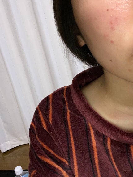 明色美顔水 薬用化粧水/美顔/化粧水を使ったクチコミ(1枚目)