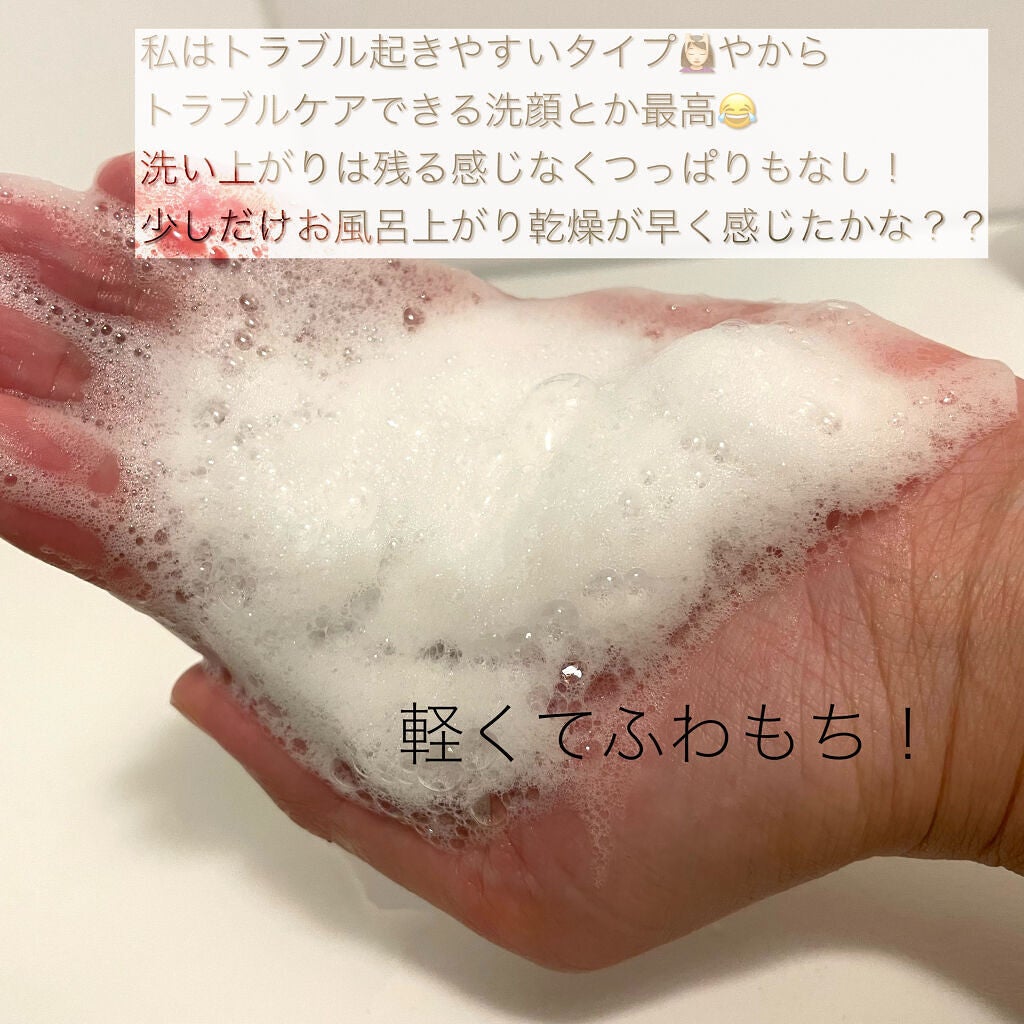 ドクダミアクネ弱酸性クレンジングフォーム/Anua/洗顔フォームを使ったクチコミ(4枚目)
