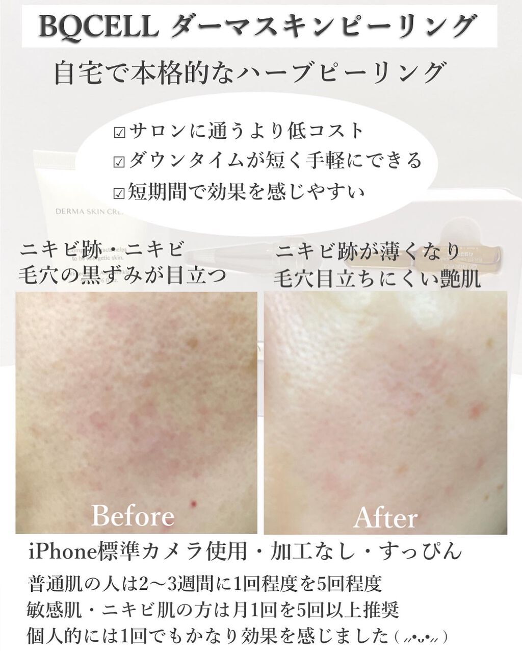 ダーマスキンピーリング/BQCELL/その他キットセットを使ったクチコミ(6枚目)