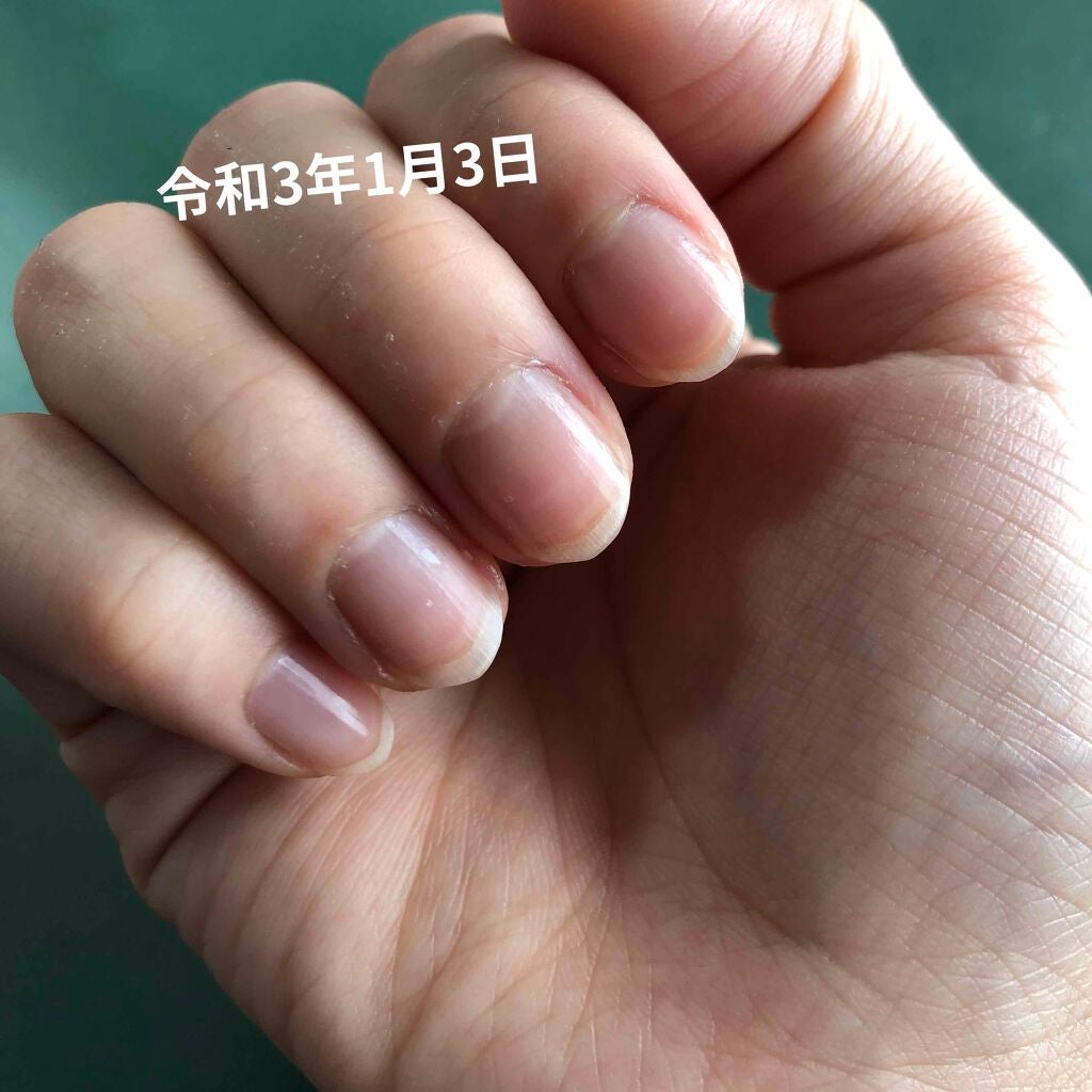 初心者ふーー on LIPS 「※令和3年10月10日追記【自分用メモ】ハイポキニウム育成チャ..」(2枚目)