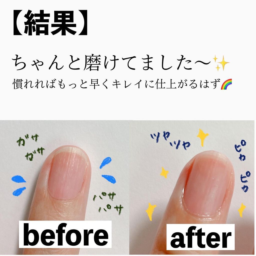 なぎ on LIPS 「【超時短!あっという間にツヤ爪♡】やっと買えた〜!#ダイソー ..」(9枚目)