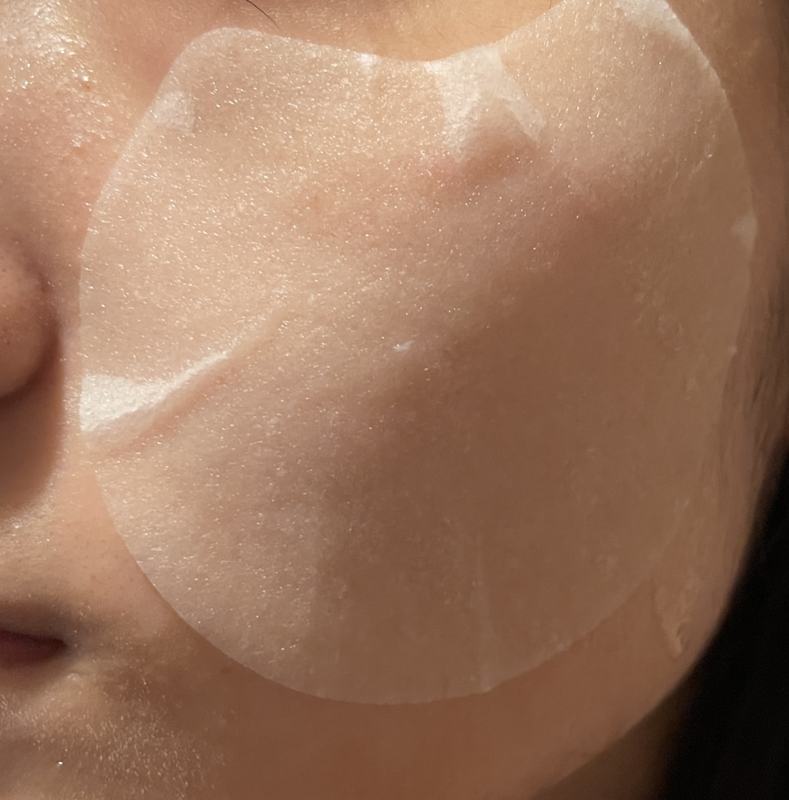 センテラ クイックカーミングパッド/SKIN1004/トナーパッドを使ったクチコミ（2枚目）