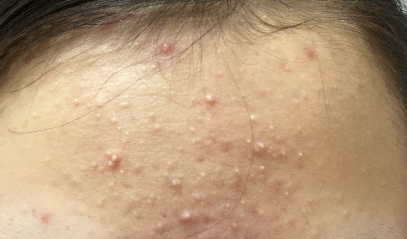 ð§ð»ãããïŒãããè·¡æ²æ»
âð»âª on LIPS ãèèãæ¥èšâ£ã ãã¶èµ€ã¿ãžã£ãŠããã§ãçœããããäžçããããð¡..ãïŒ3æç®ïŒ