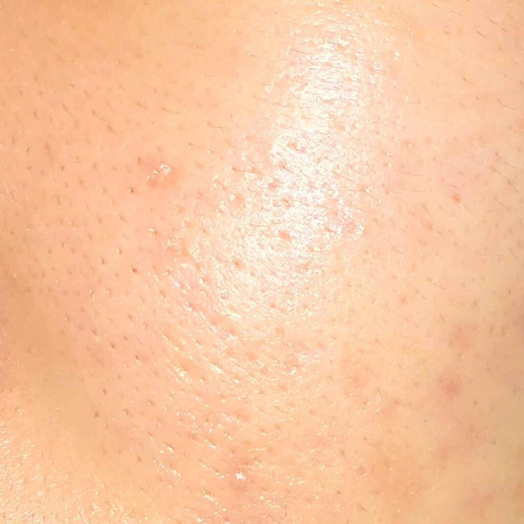 プレミアム ロイヤルジュレマスク(ヒアルロン酸)/クリアターン/シートマスク・パックを使ったクチコミ（2枚目）