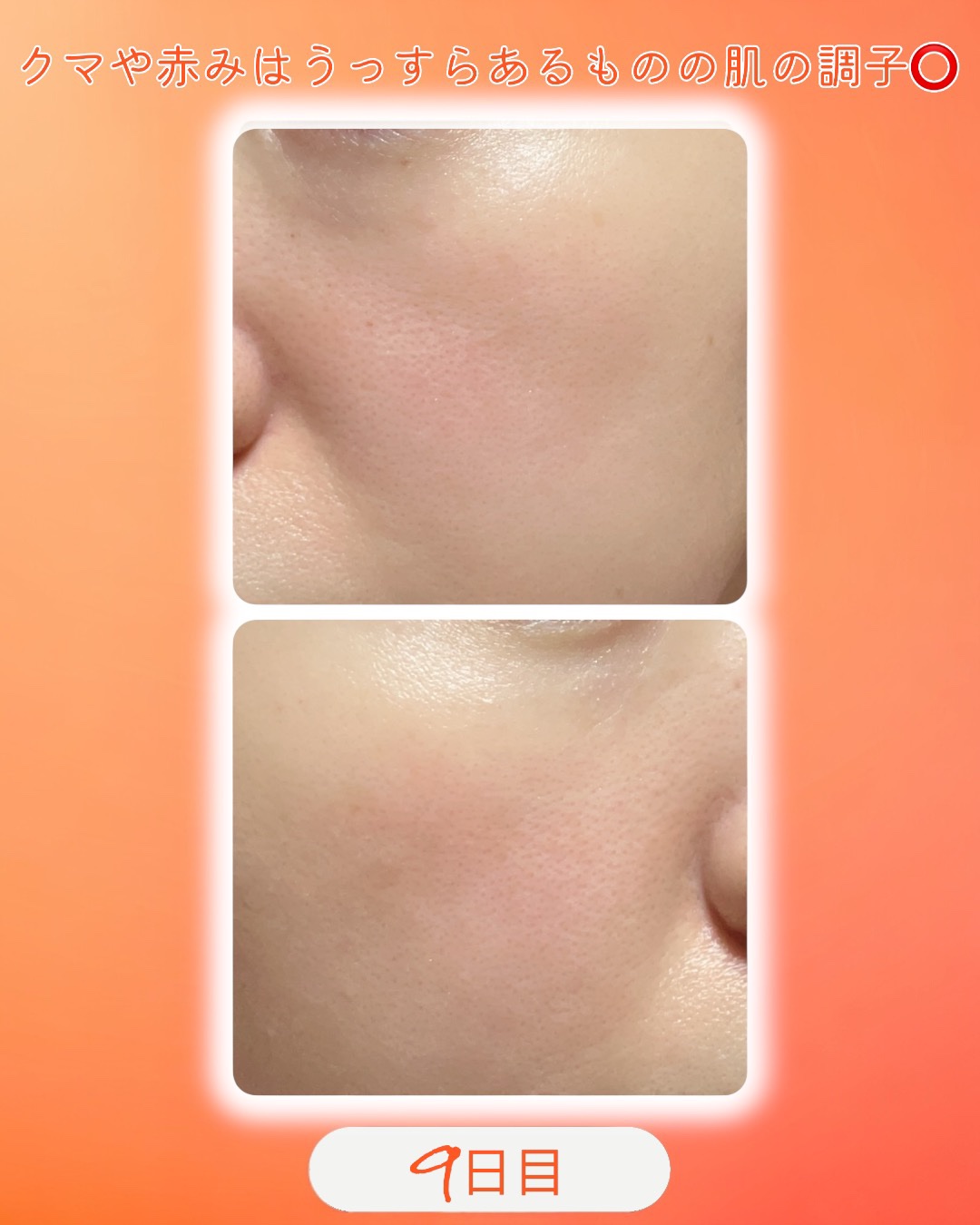 TXトーニングデイリーマスク/VT/その他スキンケアを使ったクチコミ（2枚目）