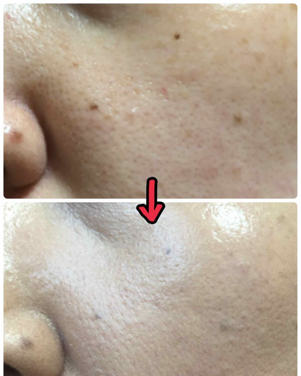 ビヨンド パーフェクティング ファンデーション 19/CLINIQUE/リキッドファンデーションを使ったクチコミ(2枚目)