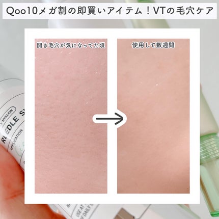 シカレチA エッセンス0.1/VT/美容液を使ったクチコミ(6枚目)