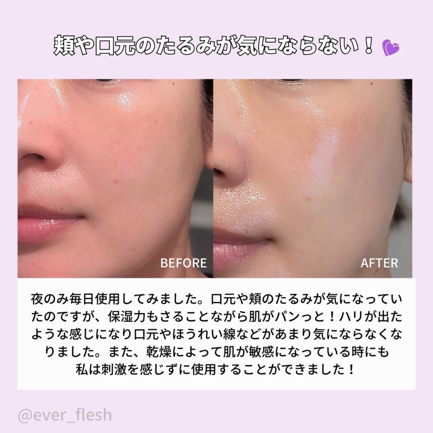 9番 NMNバイオリフト濃縮美容液/numbuzin/美容液を使ったクチコミ(4枚目)