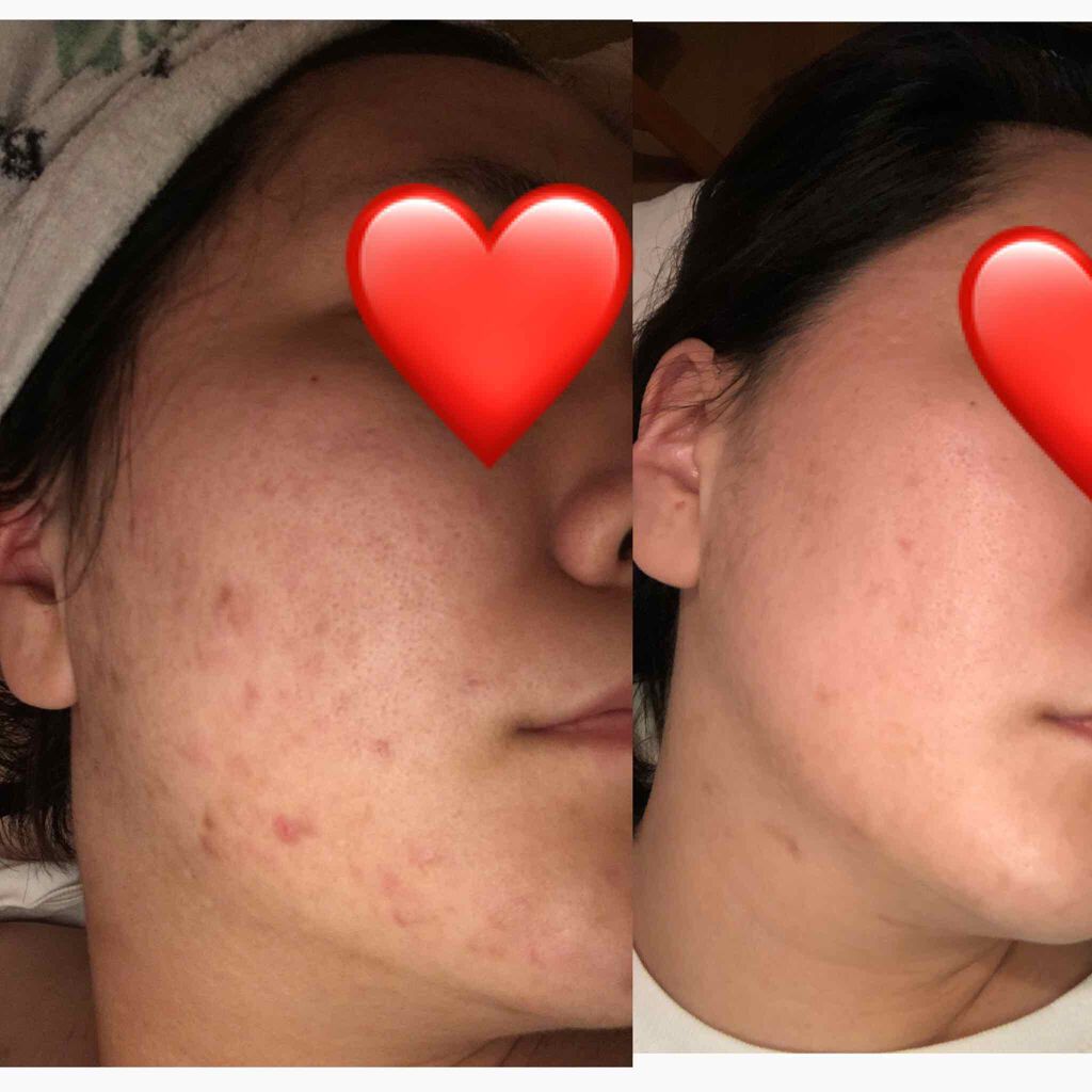 ビオメディ エッセンスミルクリーム/BioMedi/美容液を使ったクチコミ（1枚目）