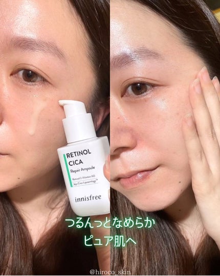 レチノール シカ リペア セラム/innisfree/美容液を使ったクチコミ(5枚目)