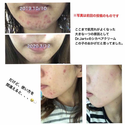 ドクタージャルト シカペア クリーム (第2世代)/Dr.Jart+/フェイスクリームを使ったクチコミ(2枚目)