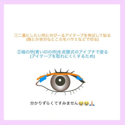 アイテープ(絆創膏タイプ、レギュラー、70枚)/DAISO/二重まぶた用アイテムを使ったクチコミ(3枚目)