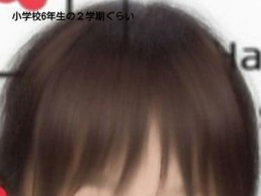 垢抜けたい女の子👧 on LIPS 「これが私の前髪の過去！！みんなこれみて元気出せ！！！！！私の現..」（2枚目）