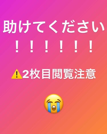 もえちゃん🐽 on LIPS 「2枚目閲覧注意です😭😭写真の通り、私は本当に鼻の毛穴が酷いです..」（1枚目）