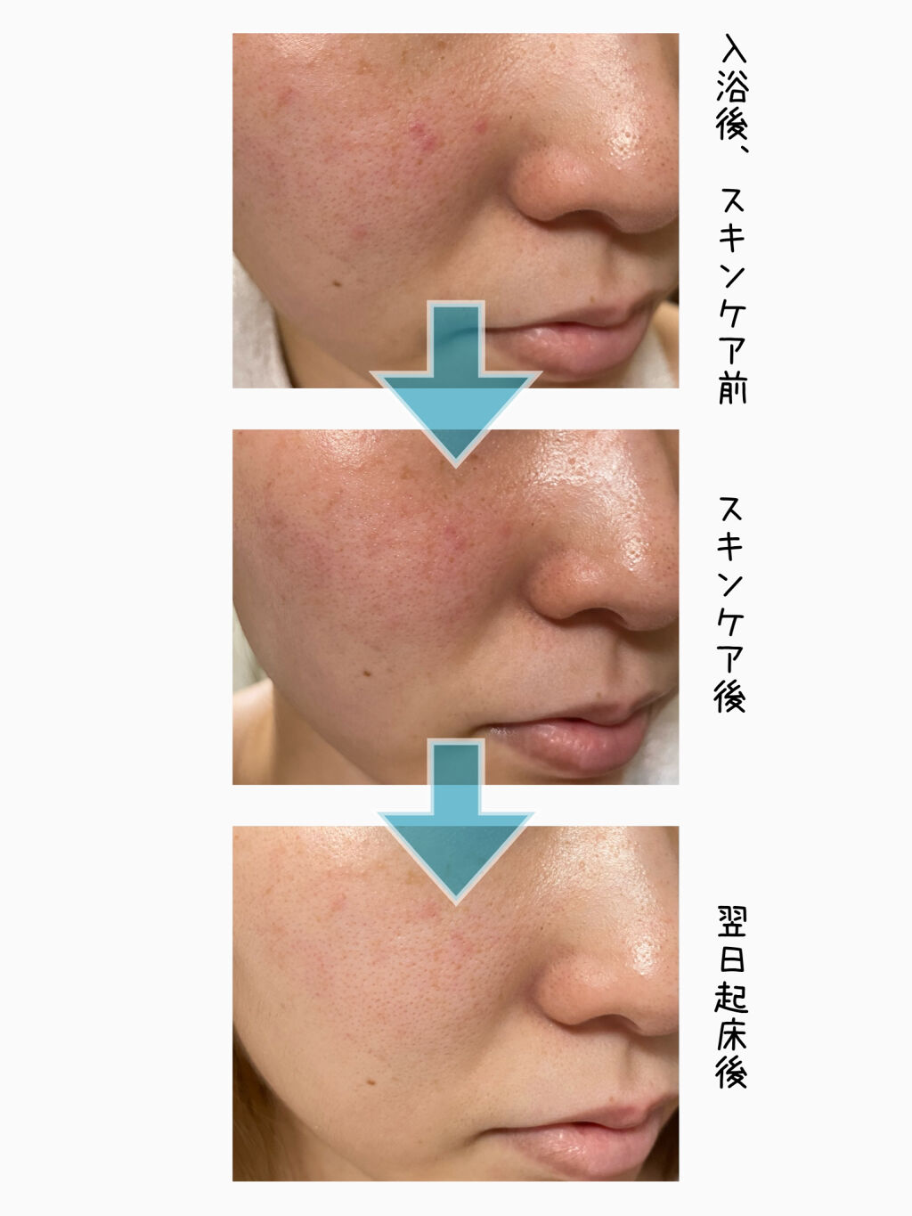 限定シートマスク パック ホワイトマスクn 透明白肌の効果に関する口コミ 本当に使用直後白くなる 実際に使って By ちー汰む 混合肌 代前半 Lips