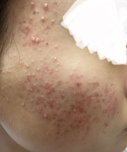 を使ったクチコミ(1枚目)