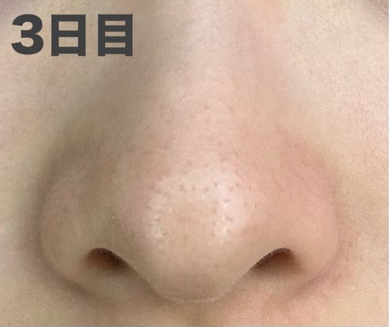 おうちdeエステ 肌をなめらかにするマッサージ洗顔ジェル 炭/ビオレ/その他洗顔料を使ったクチコミ(7枚目)