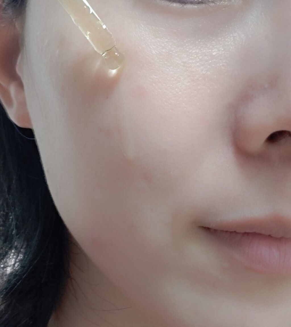 ザビタミンC23/IOPE/美容液を使ったクチコミ（3枚目）