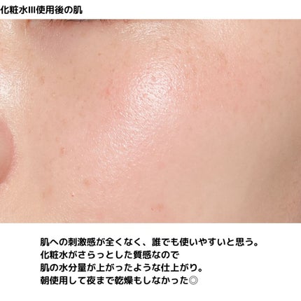 潤浸保湿 化粧水 III とてもしっとり/キュレル/化粧水を使ったクチコミ(7枚目)