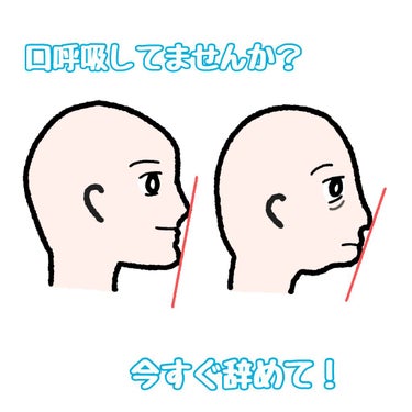 こんにちは！10000です。

皆さん、鼻呼吸してますか？
私はめちゃめちゃ口呼吸をしていました。

小さい頃から顎なし出っ歯に悩まされ、
中2〜大学2年まで矯正をしていました。

だいぶマシになりまし