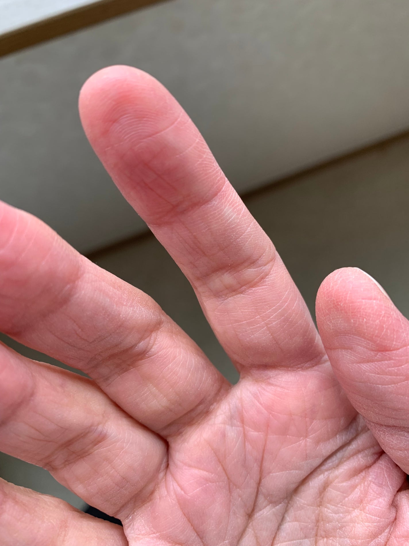 コーワ20%尿素配合クリーム(医薬品)/ケラチナミン/その他を使ったクチコミ(4枚目)