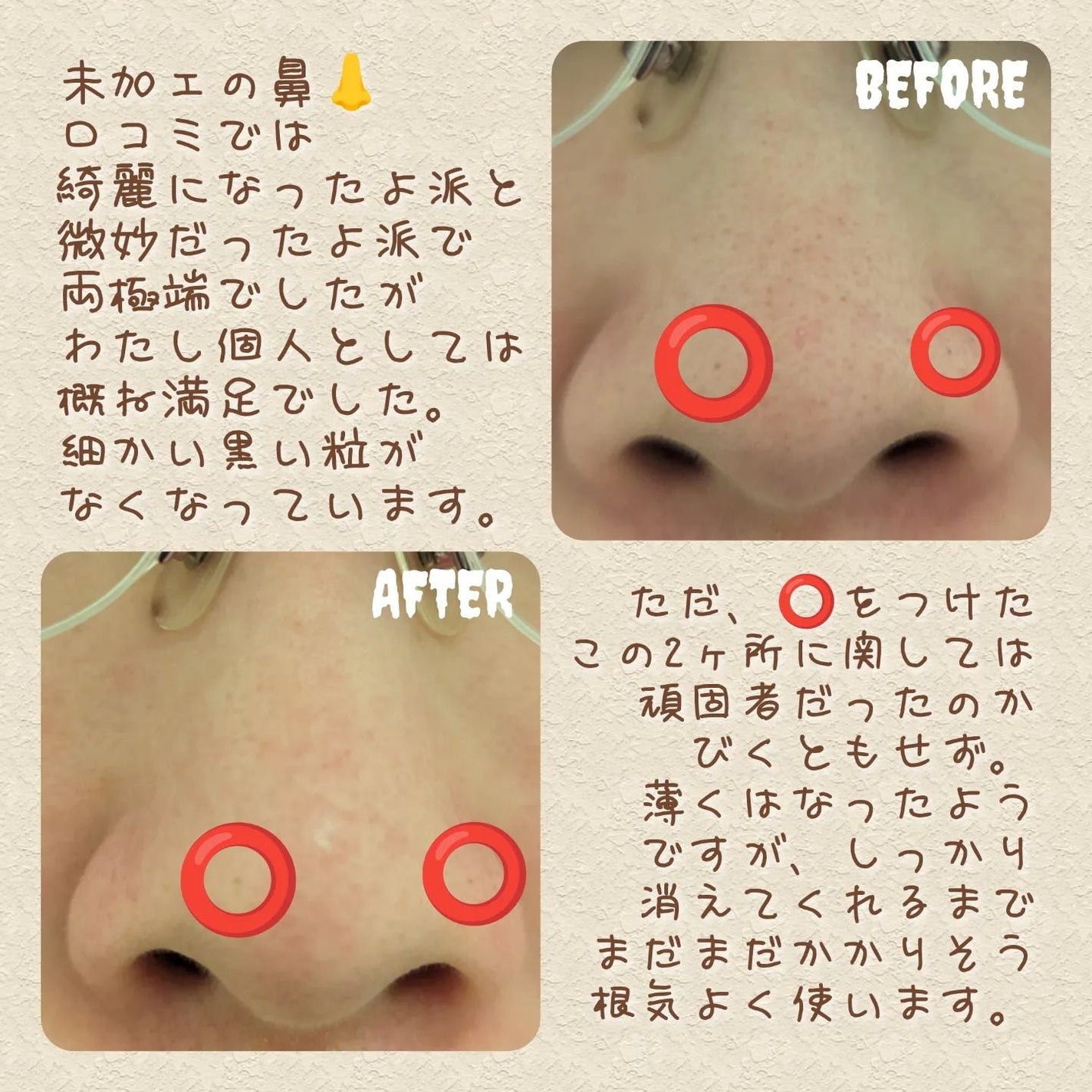 ノーモアブラックヘッド(ノーズピーリング)/One-day's you/スクラブ・ゴマージュを使ったクチコミ(3枚目)