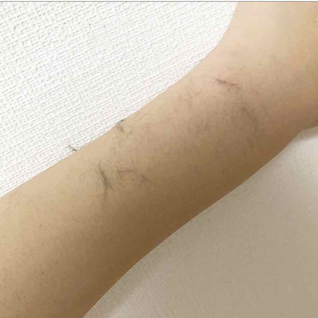 DAISO Schick顔・ボディ用カミソリ/DAISO/シェーバーを使ったクチコミ（2枚目）