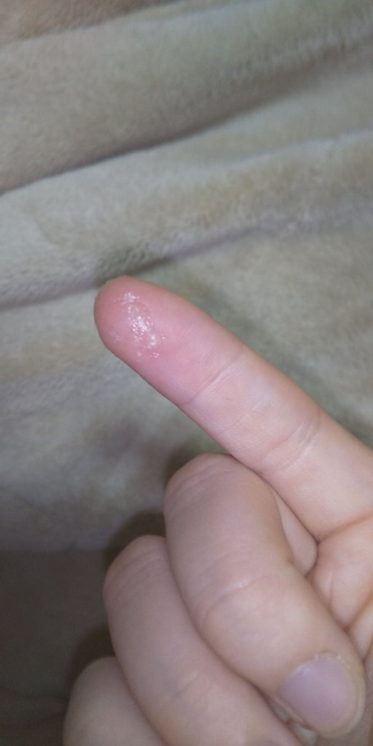 リップケア クリーム/キュレル/リップクリームを使ったクチコミ(7枚目)