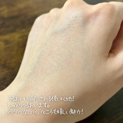 ミノン アミノモイスト 薬用アクネケア ローション/ミノン/化粧水を使ったクチコミ(5枚目)