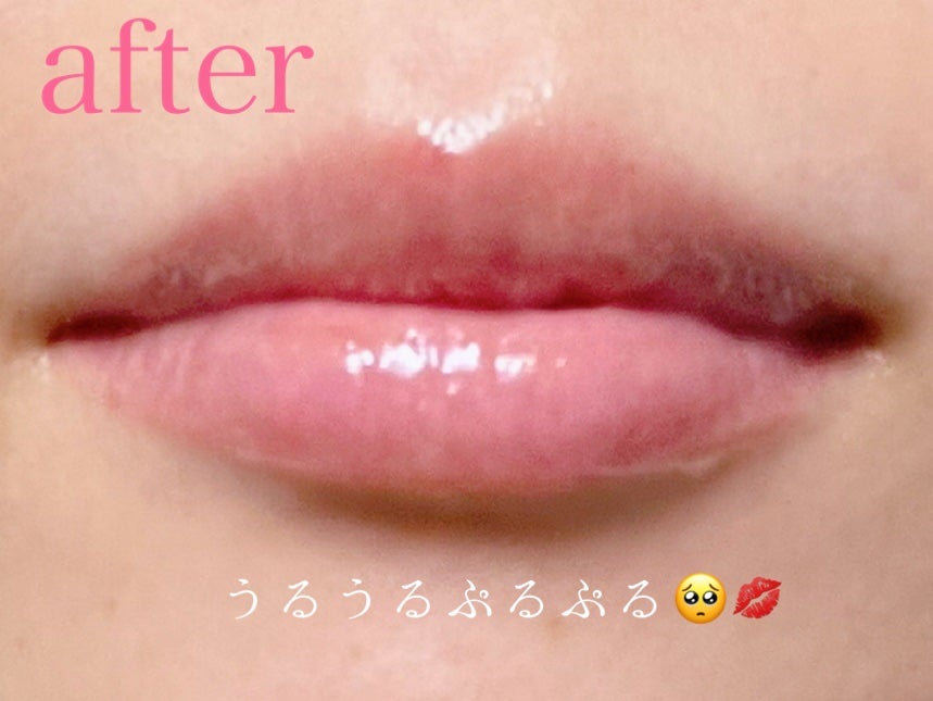 リップモイストエッセンス N/d プログラム/リップ美容液を使ったクチコミ(3枚目)