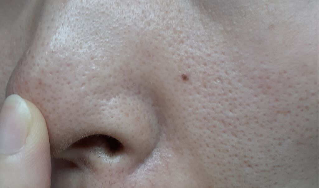 ウォーターピーリング/CaTiony/美顔器・マッサージを使ったクチコミ(4枚目)